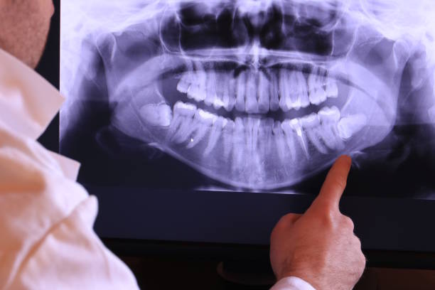 Best Broken or Chipped Tooth Repair in Gladstone, OR